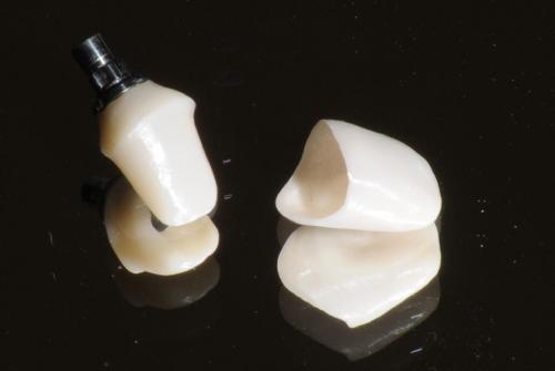 Jednotlivé korunky zirkónových protetických zubov.