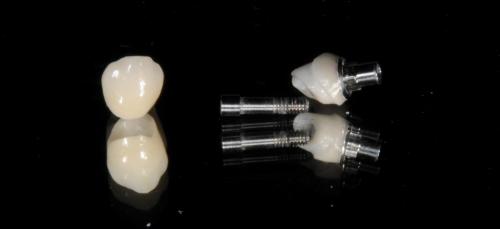 Jednotlivé protetické zuby vyrobené zo zirkónu.